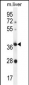 OR4A15 Antibody (C-term)